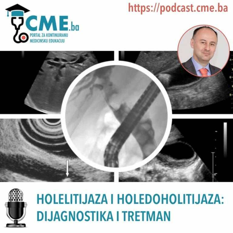 Holelitijaza i holedoholitijaza: dijagnostika i tretman
